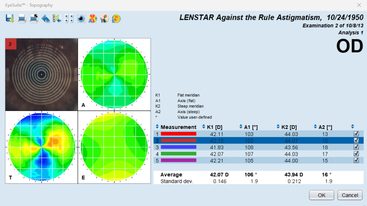 Lenstar 900 - 高精度な角膜計測 & トポグラフィー